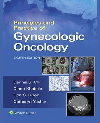 Principles and Practice of Gynecologic Oncology