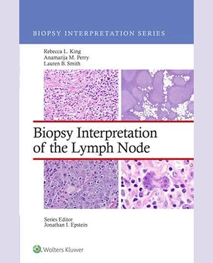 Biopsy Interpretation of the Lymph Node