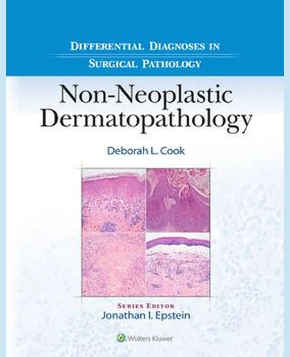 Differential Diagnoses in Surgical Pathology: Non-Neoplastic Dermatopathology