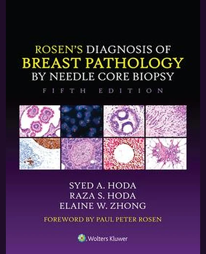 Rosen's Diagnosis of Breast Pathology by Needle Core Biopsy
