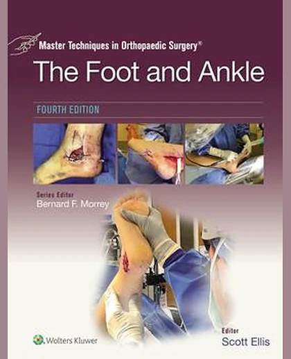 Master Techniques in Orthopaedic Surgery: The Foot and Ankle