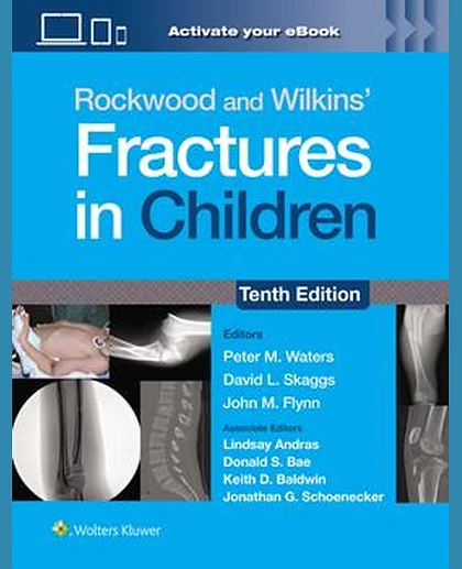 Rockwood and Wilkins' Fractures in Children