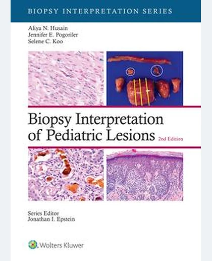 Biopsy Interpretation of Pediatric Lesions