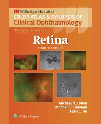 Retina