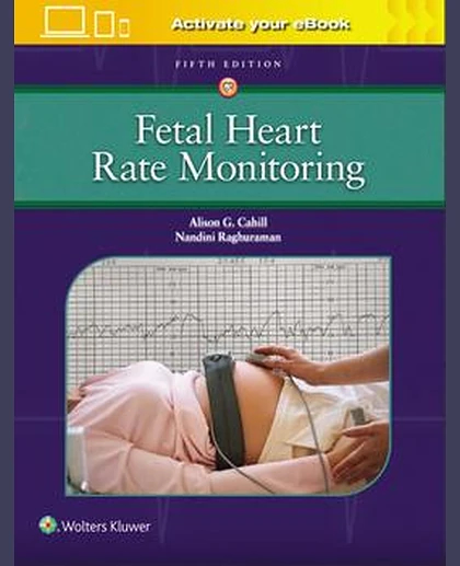Fetal Heart Rate Monitoring