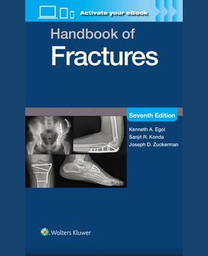 Handbook of Fractures