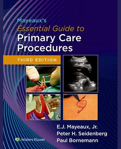 Mayeaux's Essential Guide to Primary Care Procedures