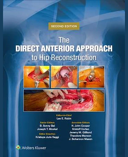 The Direct Anterior Approach to Hip Reconstruction
