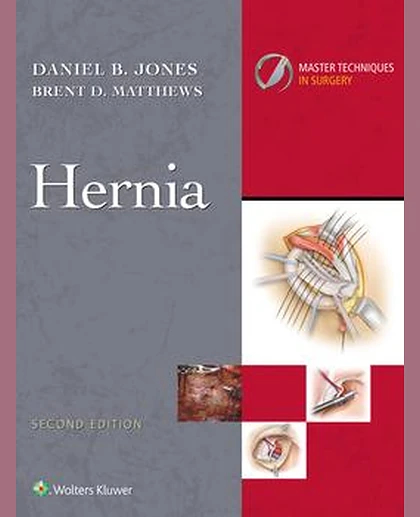 Master Techniques in Surgery: Hernia