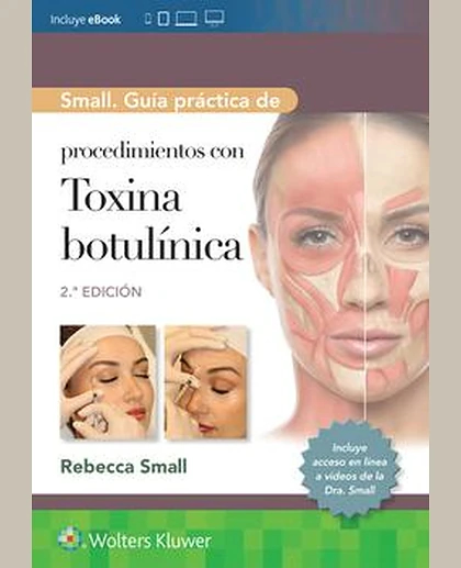 Small. Guía práctica de procedimientos con toxina botulínica