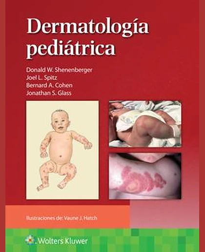 Dermatología pediátrica