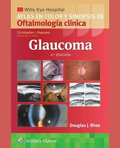 Wills Eye Hospital. Atlas en color y sinopsis de oftalmología clínica. Glaucoma