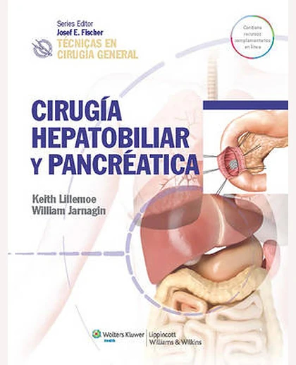 Técnicas en Cirugía General. Cirugía Hepatobiliar y Pancreática