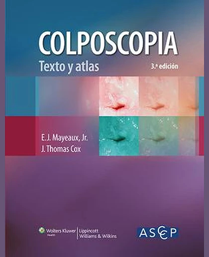 Colposcopia. Texto y atlas