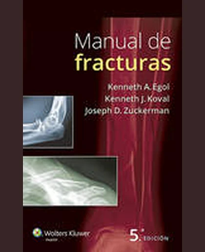 Manual de fracturas
