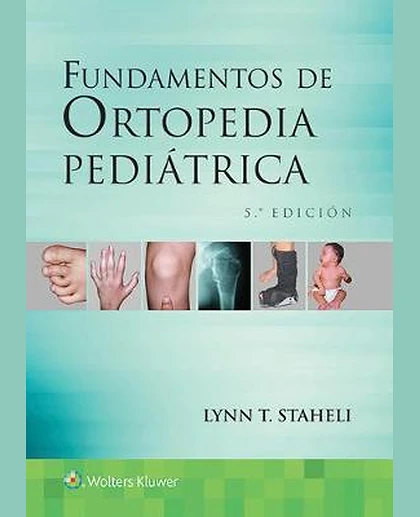 Fundamentos de Ortopedia Pediátrica