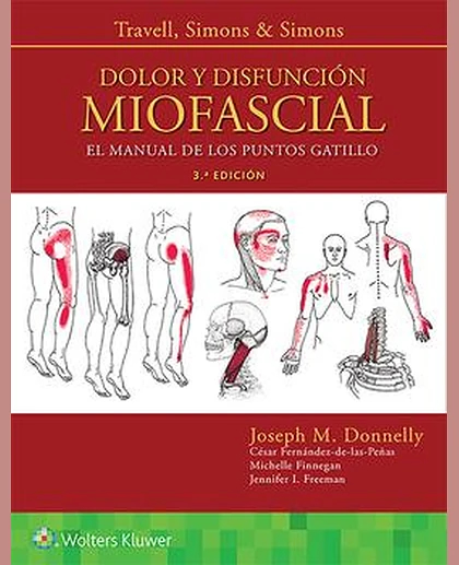 Travell, Simons & Simons. Dolor y disfunción miofascial