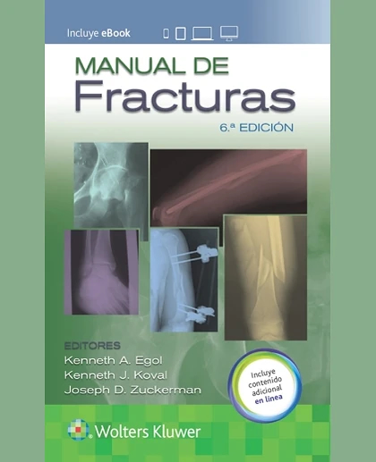 Manual de Fracturas