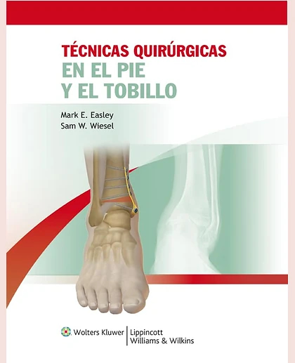 Técnicas quirúrgicas en pie y tobillo