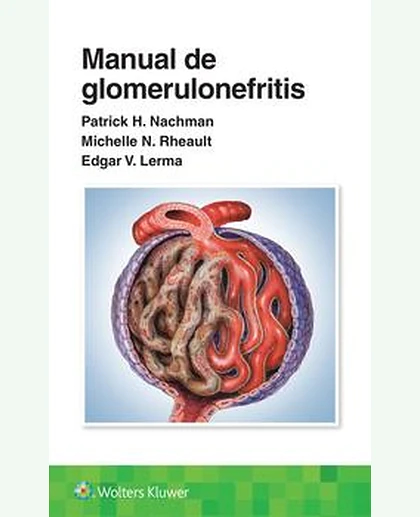 Manual de glomerulonefritis